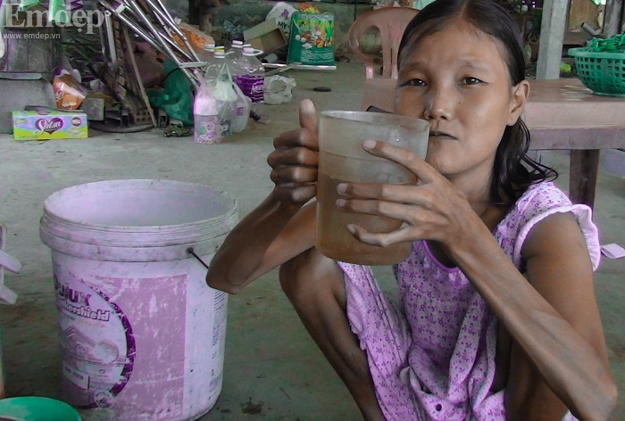 Bi kịch của cô gái ăn gấp 10 lần người bình thường, uống mỗi ngày 30 lít nước