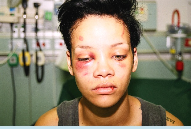Rihanna và những cuộc tình “tốn giấy mực’ của báo chí
