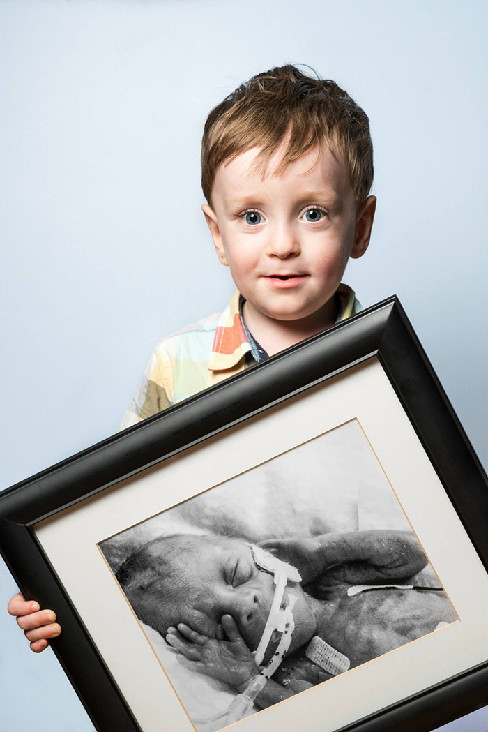 Sức sống mãnh liệt trong những bức ảnh before-after của trẻ sinh non