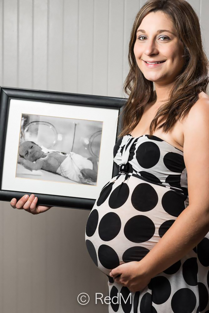 Sức sống mãnh liệt trong những bức ảnh before-after của trẻ sinh non