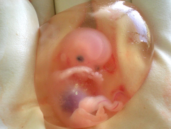 Sự phát triển da, tóc và móng tay của em bé trong bụng mẹ