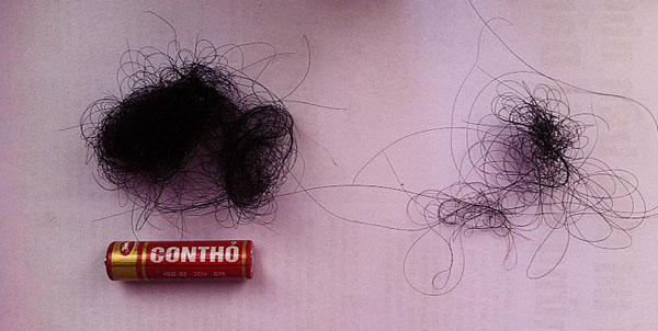 Trị tóc rụng, kích thích tóc mọc nhanh chỉ với 150.000 đồng