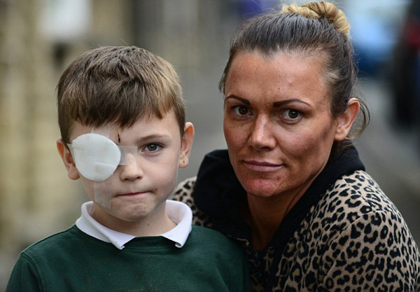 Y tá bất cẩn nhỏ keo vào mắt của bé trai khi cấp cứu