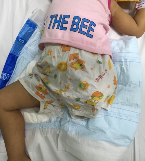 Phụ huynh bất cẩn, bé gái bị nghiền nát chân trong máy xay ở HN