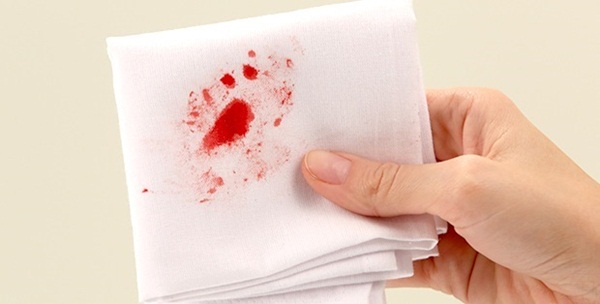 Mẹo nhỏ loại bỏ vết máu dính trên vải nhanh chóng