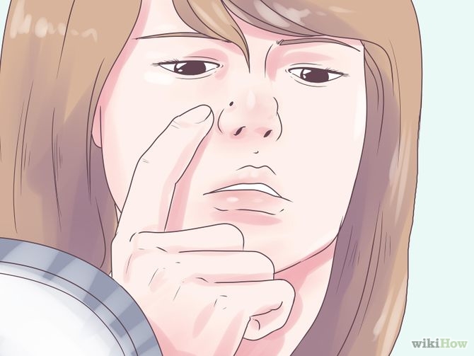 Hướng dẫn tháo khuyên mũi và ngăn ngừa sẹo lồi ở mũi hiệu quả