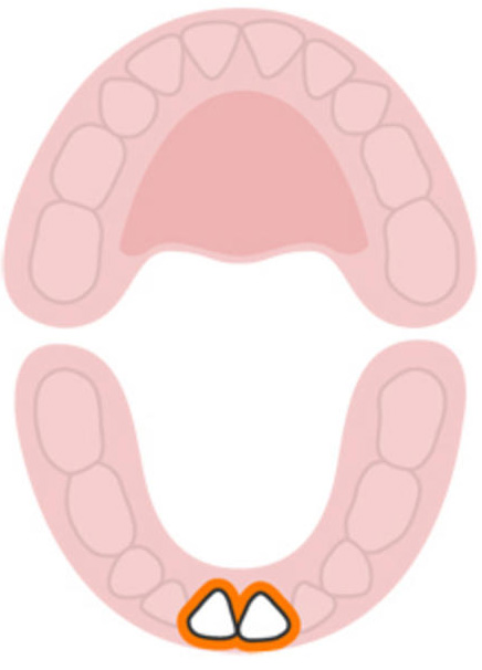Tất tần tật về quá trình mọc răng của bé