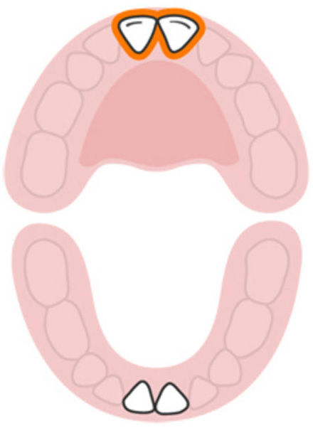 Tất tần tật về quá trình mọc răng của bé