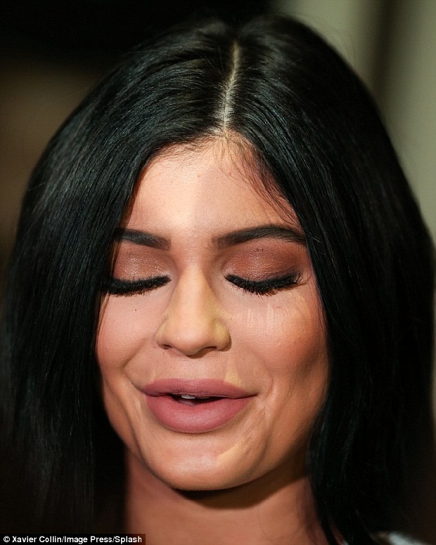 SỐC: Mặt Kylie Jenner “biến dạng” vì dao kéo quá đà