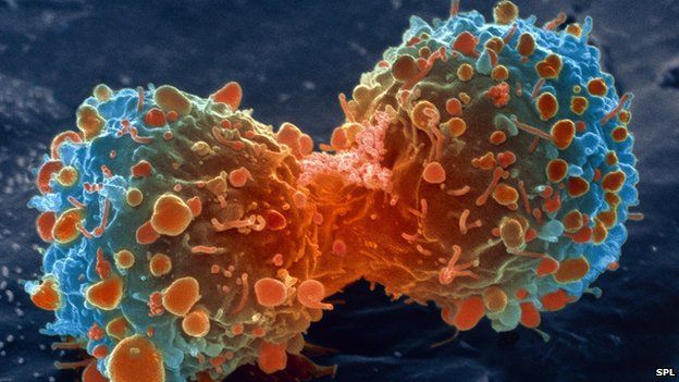Bệnh ung thư: Do lối sống không phải do...kém may mắn