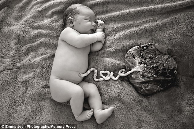 Bức ảnh bé sơ sinh với dây rốn hình chữ 'Love' gây sốt cộng đồng mạng