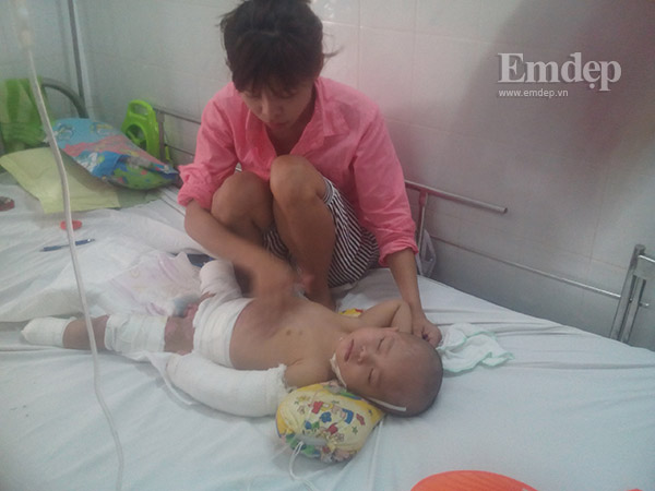 Bé mất 2 chân vì tai nạn: 'Thấy con trên giường bệnh là nước mắt tôi rơi'