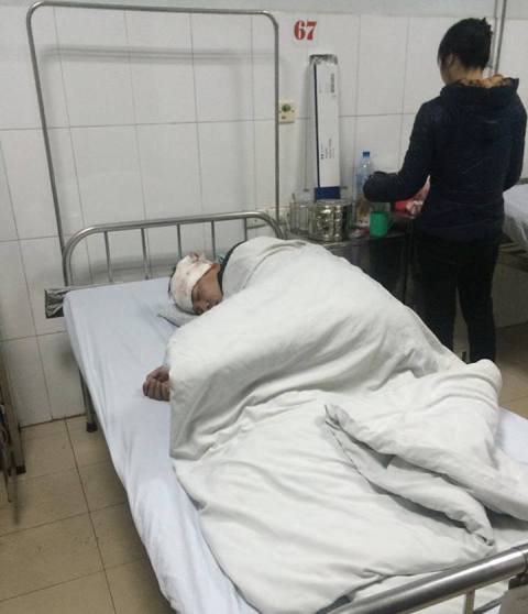 Hà Nội: Vung dao chém lái xe lia lịa, bị phản đòn bằng điếu cày gục tại chỗ