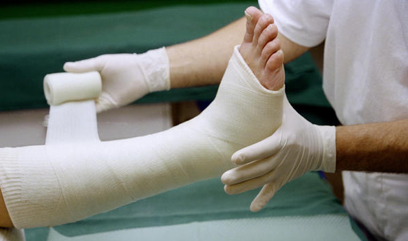 Những biến chứng nguy hiểm mà bệnh nhân gãy xương chân có thể gặp phải
