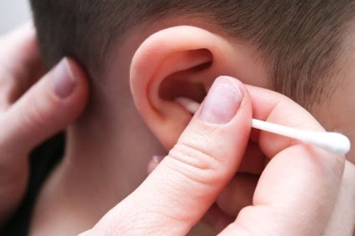 Lấy ráy tai cho trẻ: Tốn tiền vô ích, hại nhiều hơn lợi