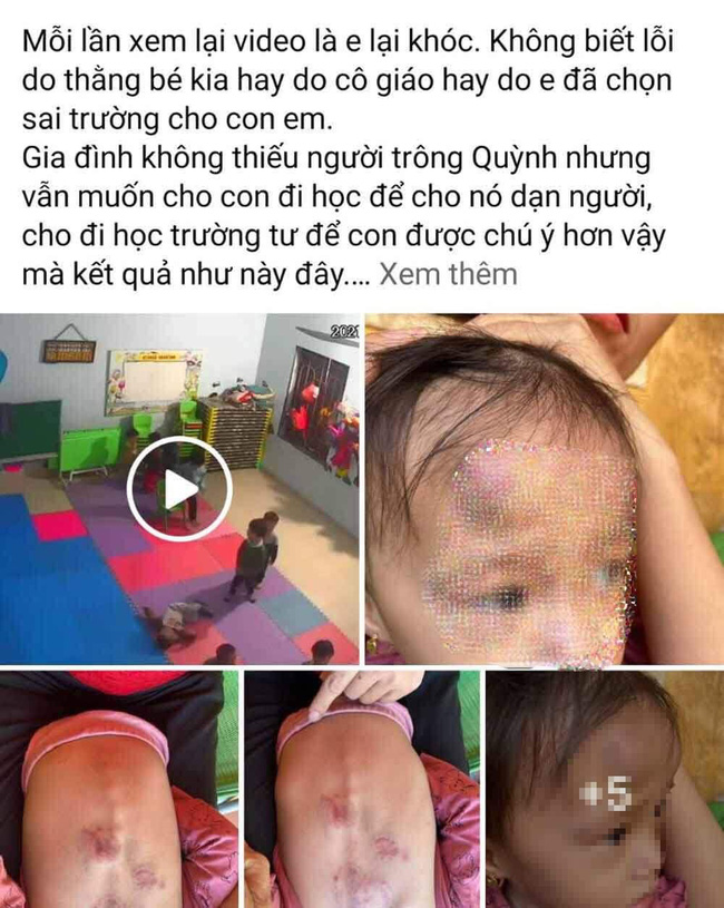 Bé gái 2 tuổi bị bạn đánh dã man trong lớp tại Bắc Giang: Phụ huynh có nên dạy con cách tự vệ từ bé?