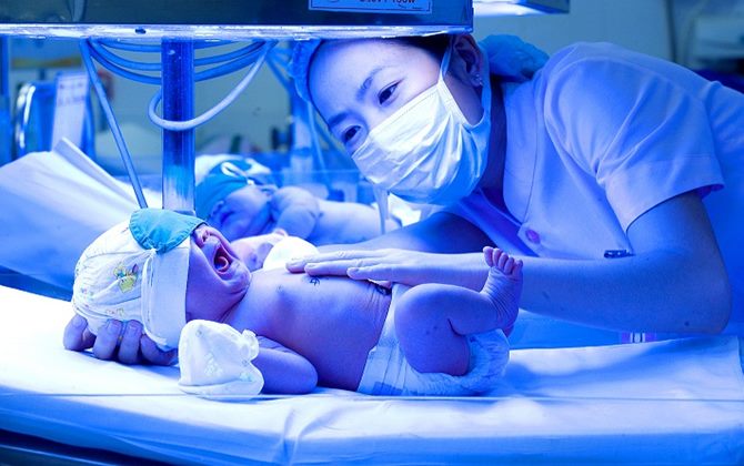 Vàng da ở trẻ sơ sinh: Những điều mẹ phải nhớ khi có con