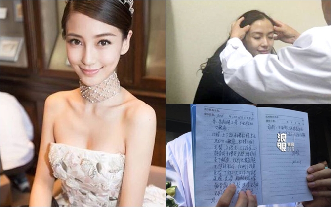 Bác sĩ xác nhận Angelababy chưa từng dao kéo