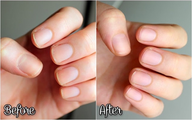 10 mẹo đẹp "từ chân lên đầu" tại nhà cực hiệu quả