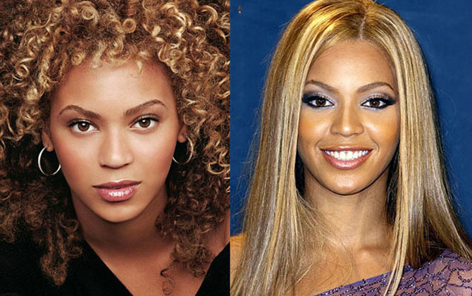 Nâng mũi mang lại những lợi ích không ngờ cho sức khỏe