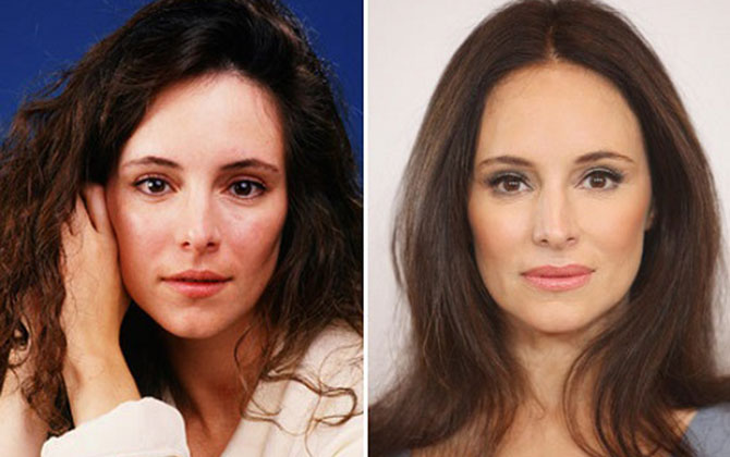 Chăm sóc mắt sau phẫu thuật