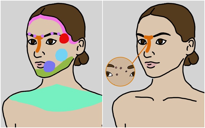 Nhìn vị trí mụn đoán sức khỏe bên trong