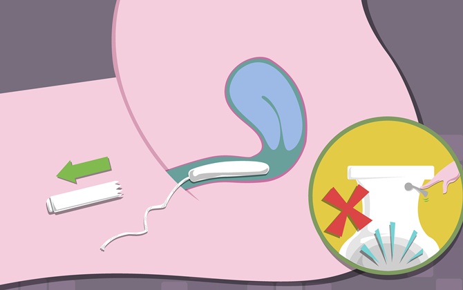 Những lo ngại về tampon trên thực tế không bao giờ xảy ra