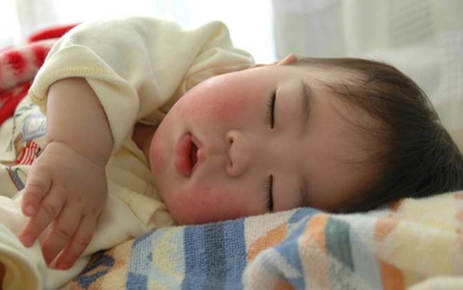 Phân biệt mồ hôi trộm sinh lý và bệnh lý ở trẻ