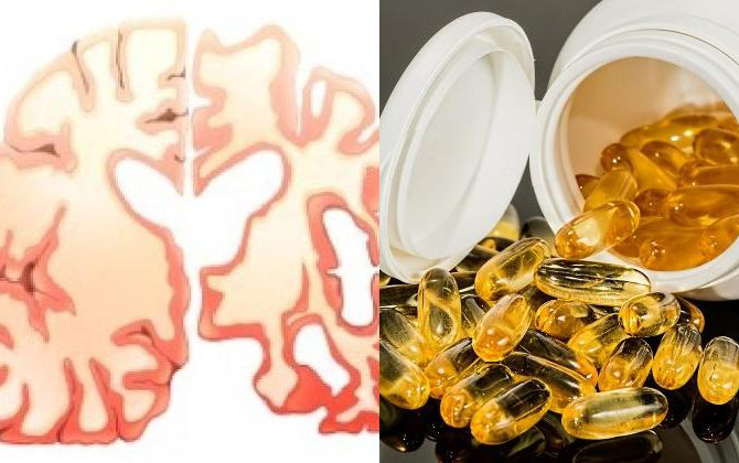 5 loại vitamin quan trọng cho não giúp phòng ngừa Alzheimer và mất trí nhớ 