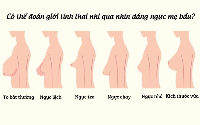 Dáng ngực của mẹ có thể đoán trước giới tính thai nhi?