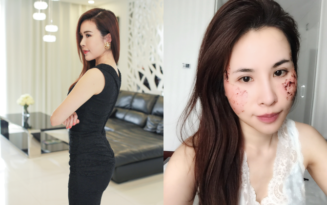 “Rùng mình” trước cách làm đẹp bằng máu của Fashionista Hà Nội