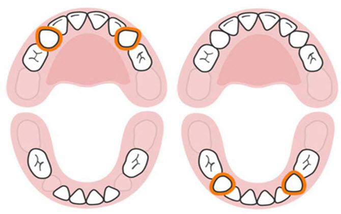 Những điều cần biết về quá trình mọc răng ở trẻ