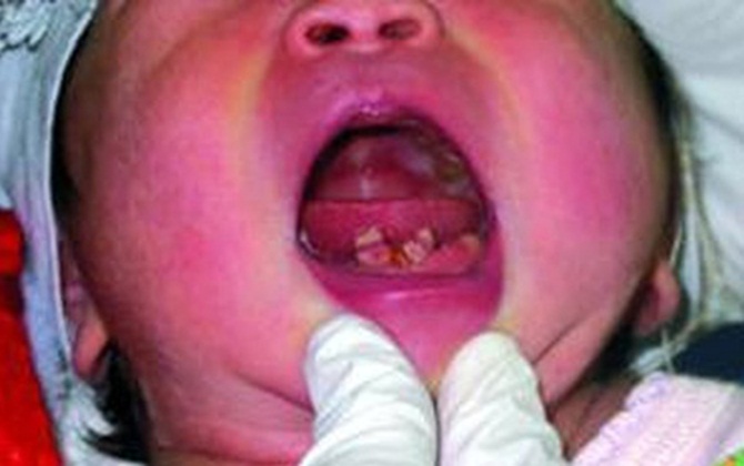 Ca mổ đẻ "giật bắn mình" ở Trung Quốc
