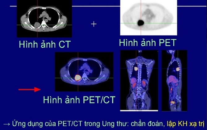 Chuyện lạ có thật: Những người chữa khỏi ung thư ở Việt Nam