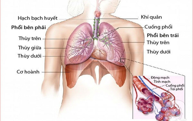 Triệu chứng ung thư phổi ở người không hút thuốc   
                                        
                                        
                                        
