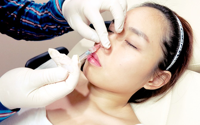 Những điều nên biết trước khi tiêm filler