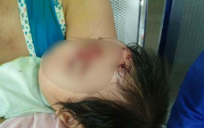 Khỉ mất con quay về bắt trẻ 2 tháng tuổi: Nhân duyên với gia đình nạn nhân