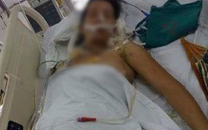 Thai phụ bị xe chèn ngang người, cứu sống con 32 tuần tuổi