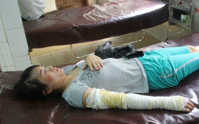 Dội ấm nước đang sôi lên đầu vợ vì tự ý đi làm đẹp