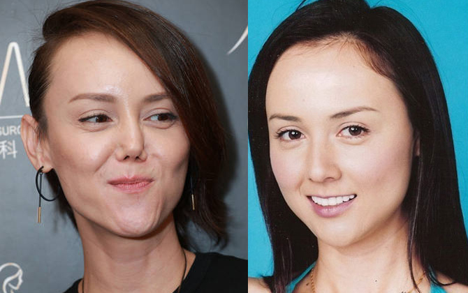 Hoa hậu đẹp nhất ATV xấu khác thường vì thẩm mỹ mũi hỏng?