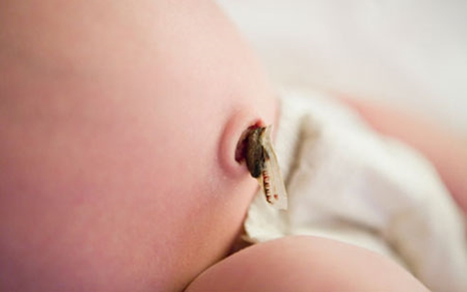 101 cách mẹ xử lý cuống rốn của con sau khi rụng