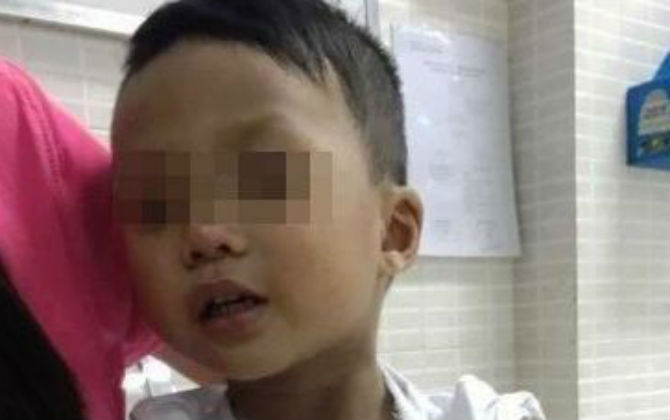 Cô đập bàn làm gãy tay trẻ: Tường trình của trường nói gì?