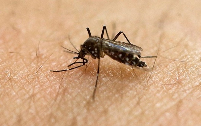 4 biến chứng kinh hoàng của virus Zika