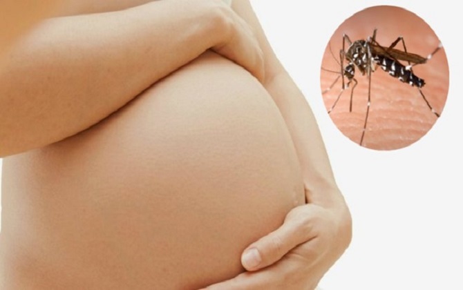 Quy trình chăm sóc sức khỏe thai phụ nhiễm Zika