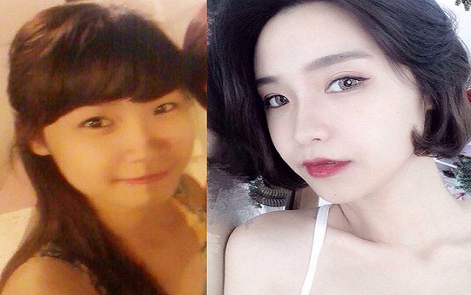 Thay đổi đến thế này, bảo sao con gái Việt lại đua nhau 'dao kéo'