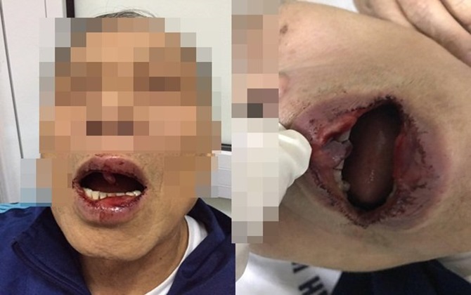 Vụ tiến sĩ 76 tuổi bị đánh: Người hành hung sẽ bị tội gì?