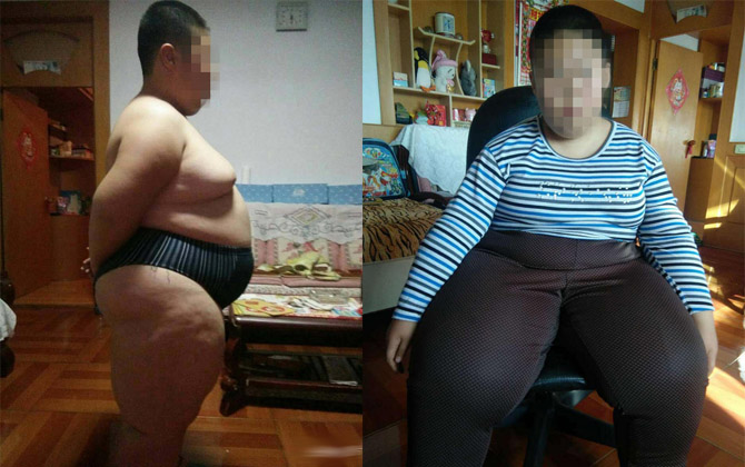 Bé trai 10 tuổi phải ngủ ngồi suốt nhiều năm liền vì nặng gần 100kg