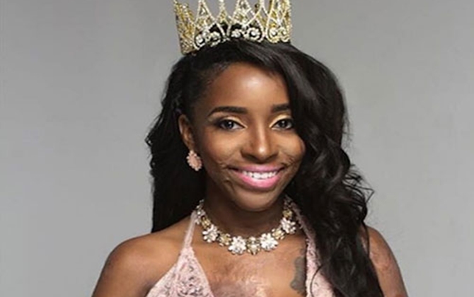 Ngại sinh con, hãy đọc ngay 4 câu chuyện tạo cảm hứng mãnh liệt này!