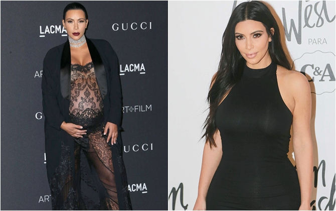 Kim Kardashian tiết lộ mới phẫu thuật thẩm mỹ để loại bỏ vết rạn da sau khi mang thai lần 2