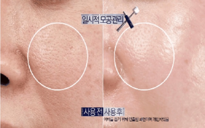 2 sản phẩm trẻ hóa da được dân Hàn ví như 'thần thánh', giúp da căng mịn và sáng bóng ngay tức thì